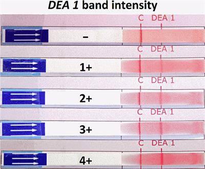 Survey of Blood Groups DEA 1, DEA 4, DEA 5, Dal, and Kai 1/Kai 2 in Different Canine Breeds From a Diagnostic Laboratory in Germany